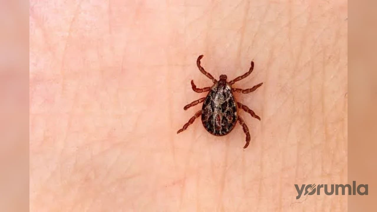 Sivas’ta KKKA şüphesiyle tedavi gören kişi hayatını kaybetti