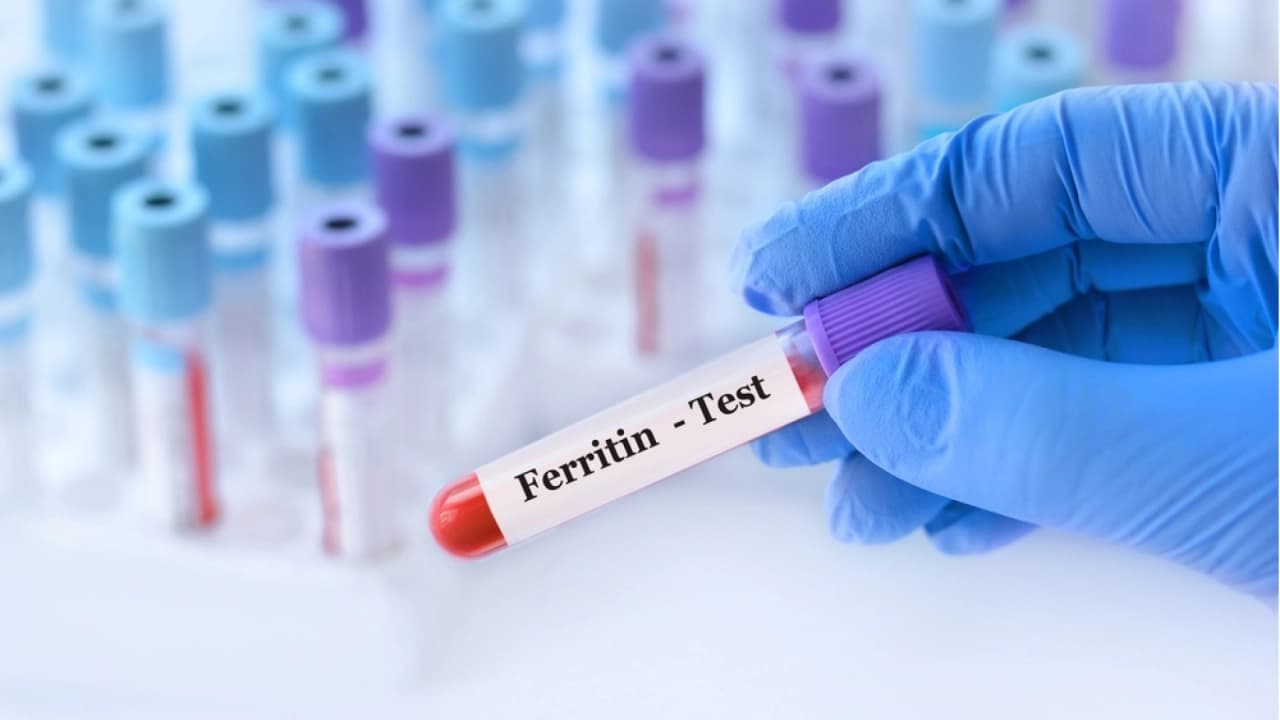 Sosyal medyada yayılan ferritin yüzü trendine doktorlardan uyarı