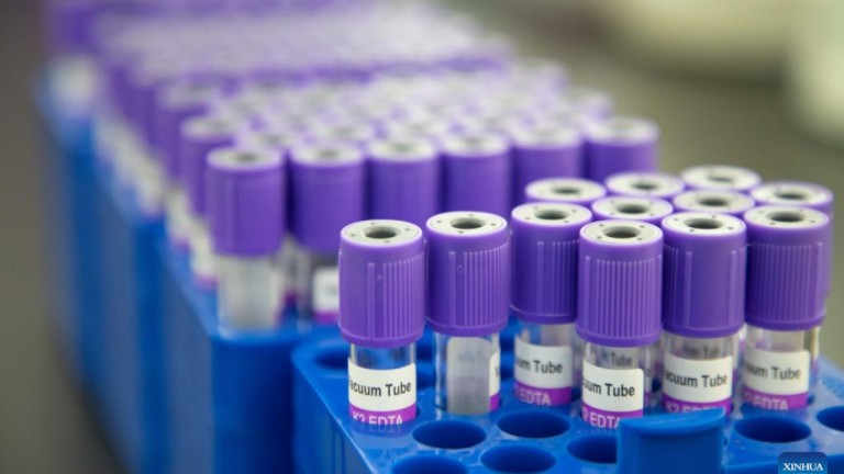 NHS'ten kanserle mücadelede devrim niteliğinde adım: Yapay zeka destekli kan testi klinik denemelere başlıyor