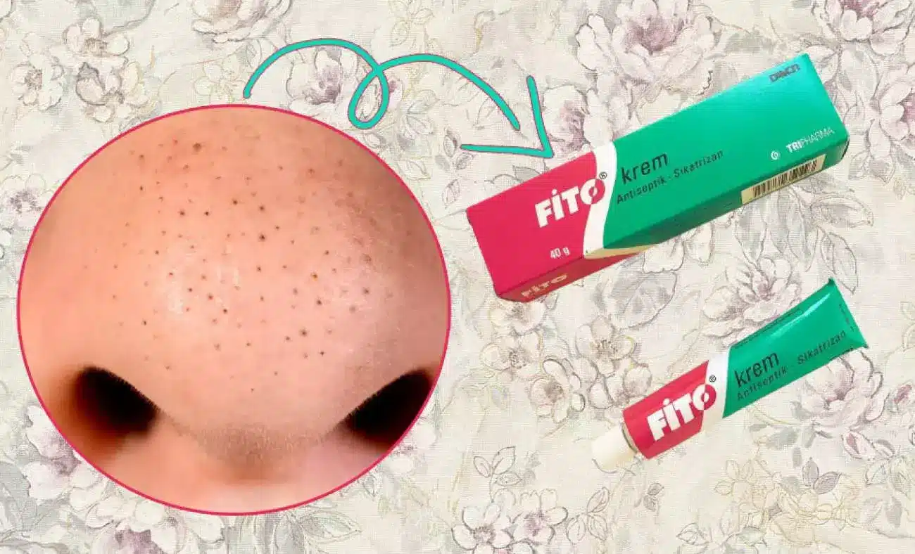 Fito Krem Ne İşe Yarar